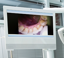 Intraoral Cameras